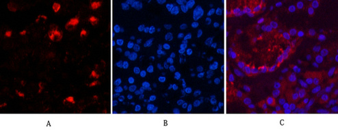 YC0006IF-Human-lung-cancer2016-12-14-74.jpg